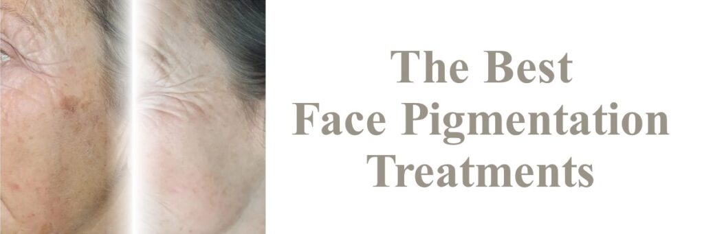 Before and after a chemical peel next to the words 'the best face pigmentation treatments'